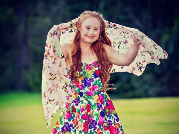 Adolescente com Síndrome de Down perde 20kg e assina primeiro contrato como modelo Instagram/Reprodução