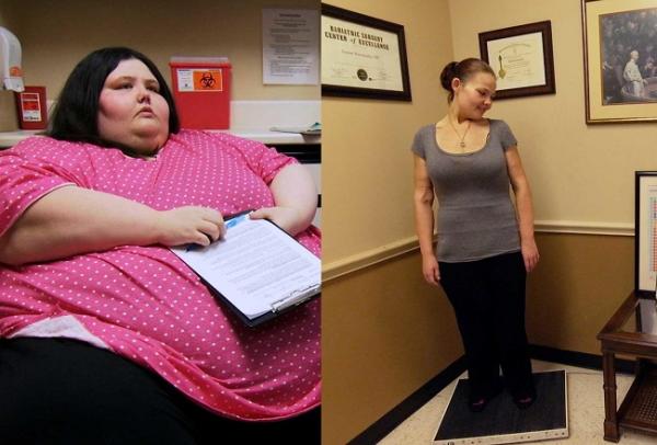 Mesmo depois de vencer obesidade, americana ainda se vê