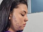 Jovem paulista que teve nome do ex-namorado marcado à força no rosto inicia remoção da tatuagem Instagram @cinthiasouza.adv / Reprodução/Reprodução